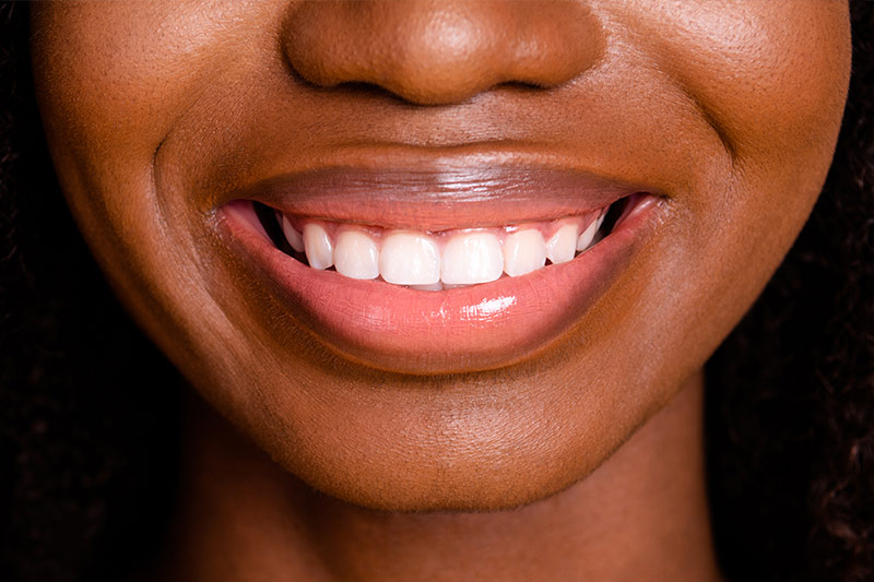 Smile Makeover in Trumbull