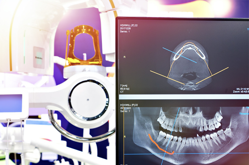 Digital X-Rays in Trumbull